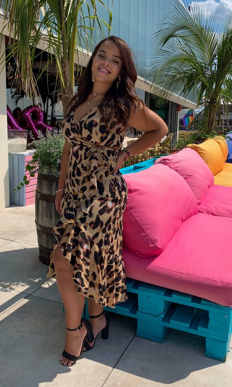 Patients 20-39 Years Old Before & After Gallery - Patient 14494253 - Image 2