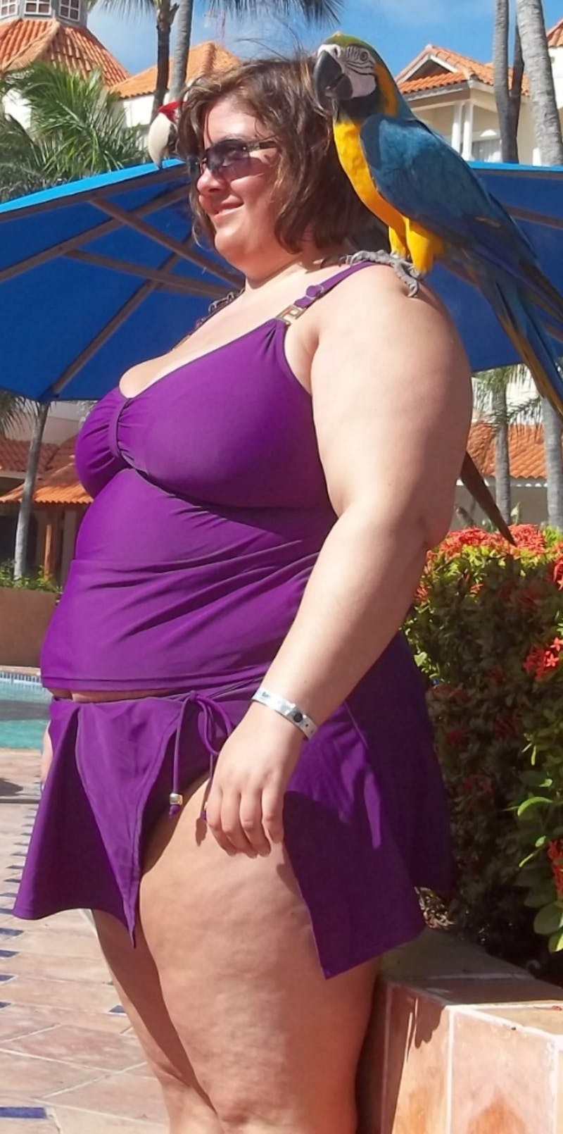 Patients 20-39 Years Old Before & After Gallery - Patient 14494254 - Image 1