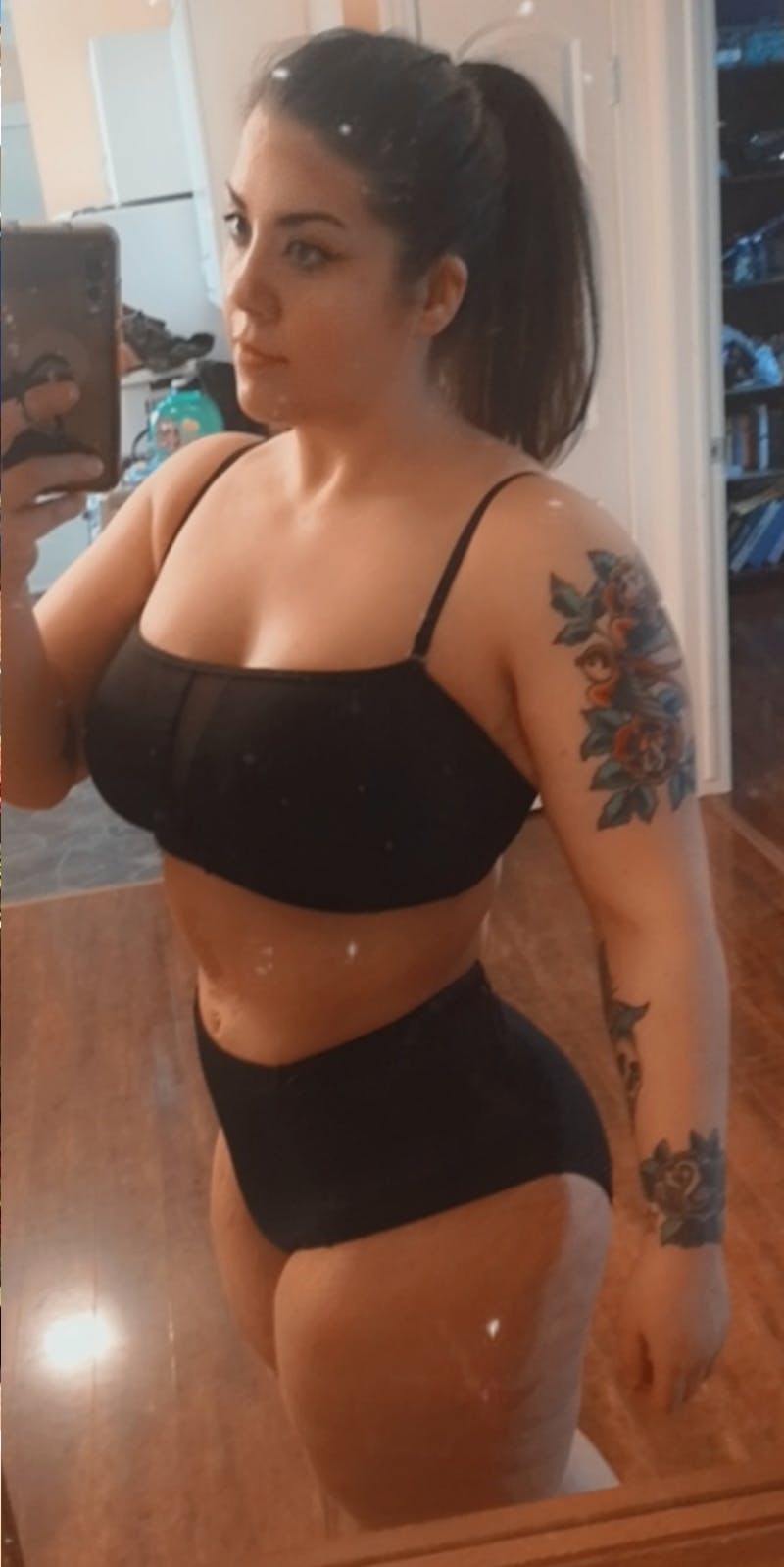 Patients 20-39 Years Old Before & After Gallery - Patient 14494254 - Image 2