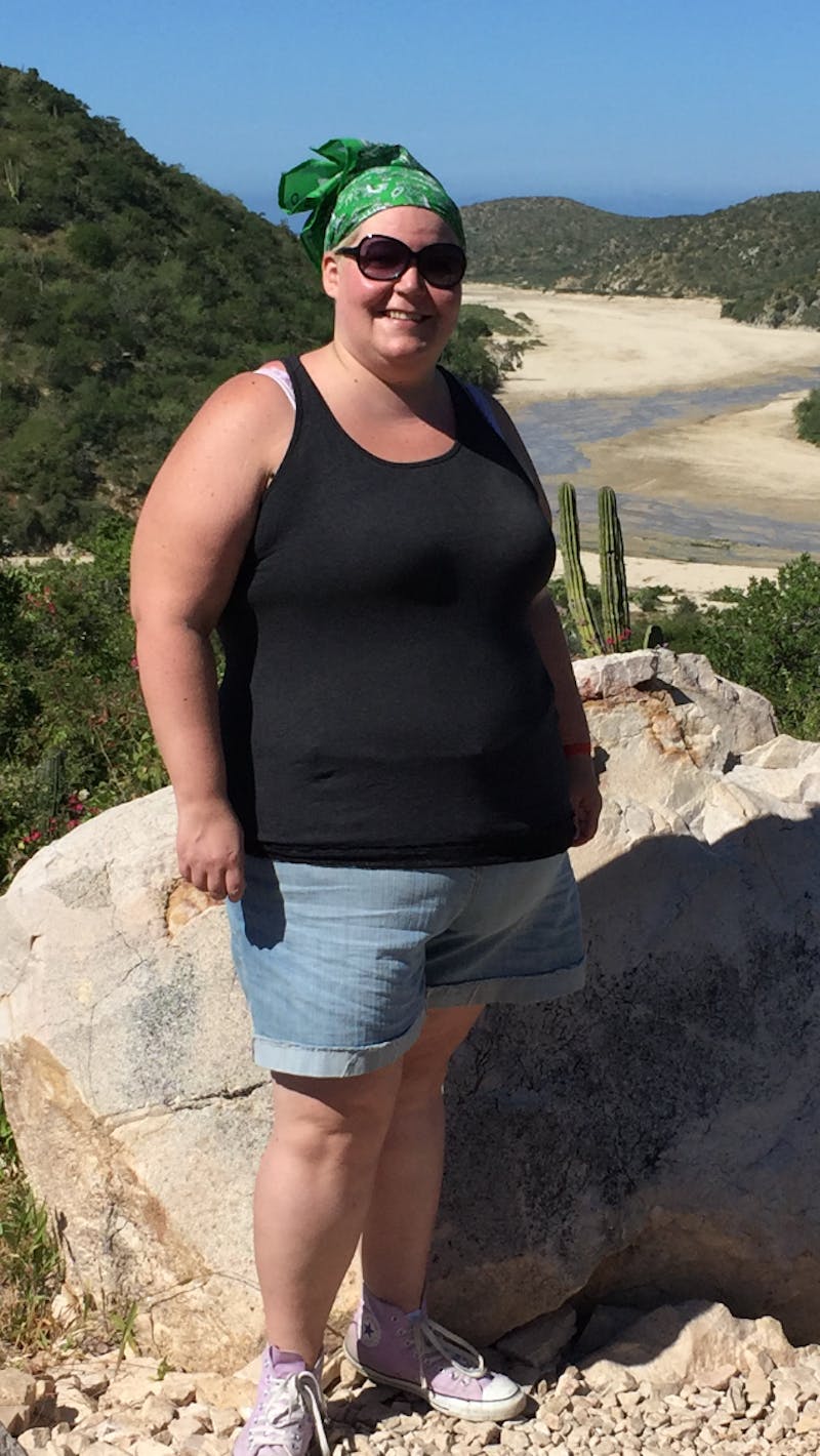 Patients 20-39 Years Old Before & After Gallery - Patient 14494255 - Image 1