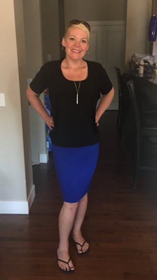 Patients 20-39 Years Old Before & After Gallery - Patient 14494255 - Image 2