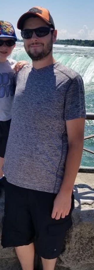 Patients 20-39 Years Old Before & After Gallery - Patient 14494257 - Image 2