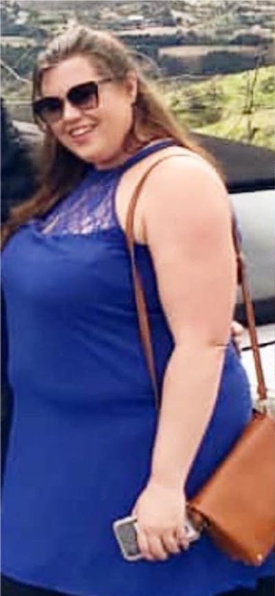 Patients 20-39 Years Old Before & After Gallery - Patient 14494258 - Image 1