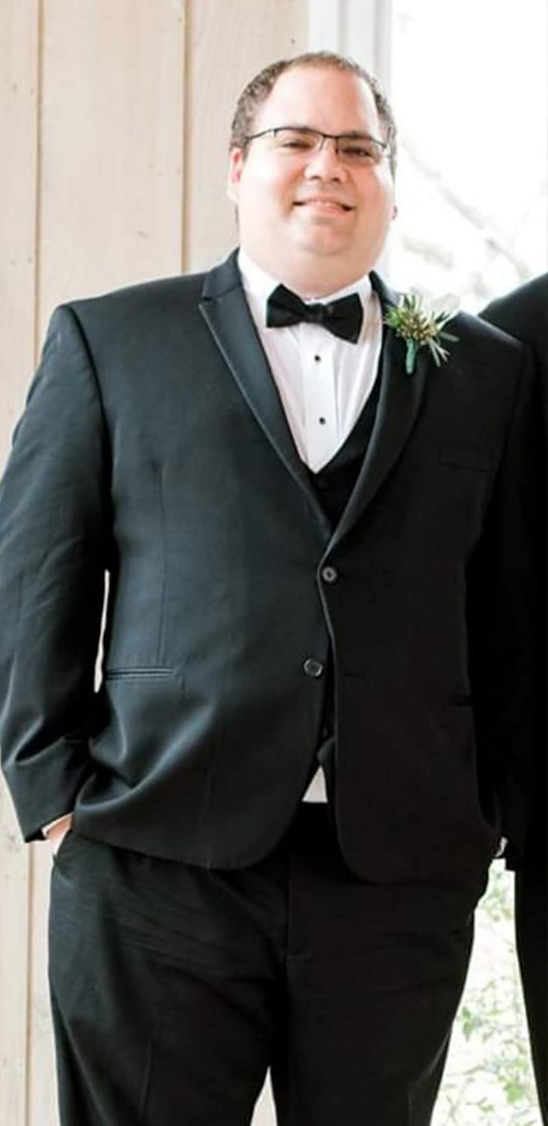 Patients 20-39 Years Old Before & After Gallery - Patient 14494259 - Image 1