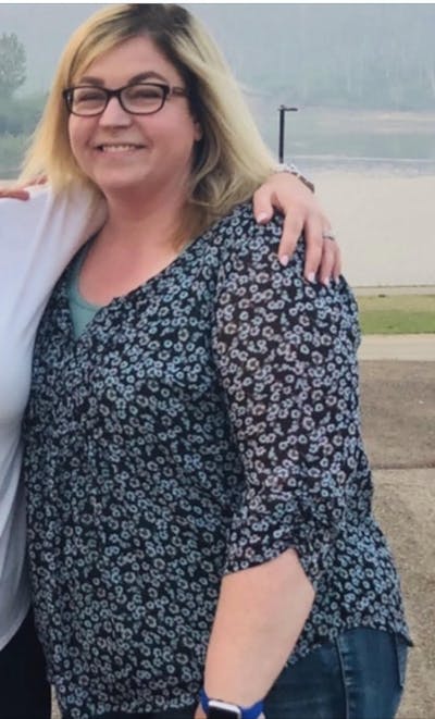 Patients 20-39 Years Old Before & After Gallery - Patient 14494260 - Image 1