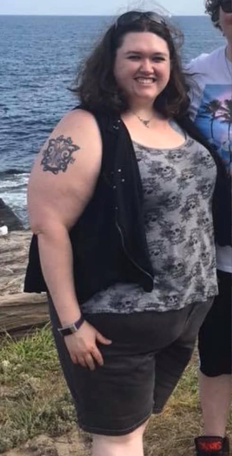 Patients 20-39 Years Old Before & After Gallery - Patient 14494262 - Image 1