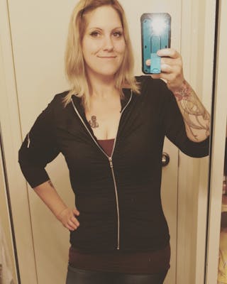 Patients 20-39 Years Old Before & After Gallery - Patient 14494265 - Image 2