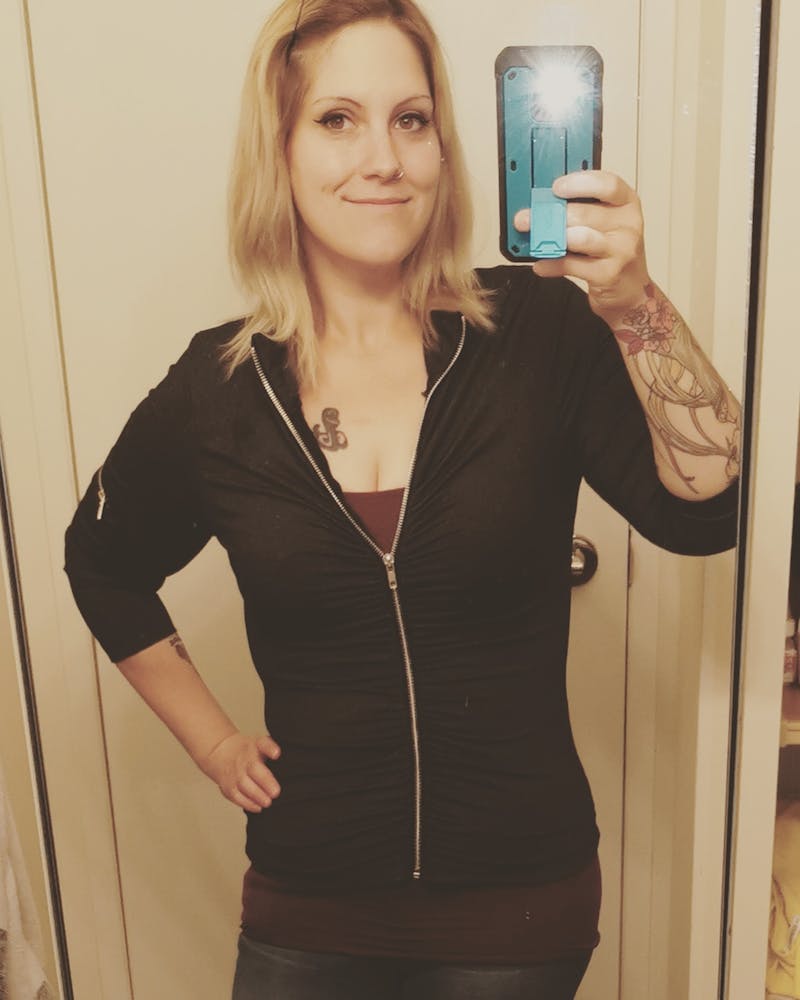 Patients 20-39 Years Old Before & After Gallery - Patient 14494265 - Image 2