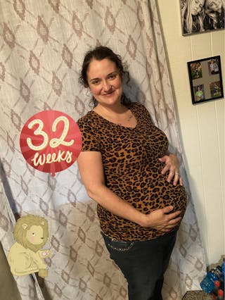 Patients 20-39 Years Old Before & After Gallery - Patient 14494266 - Image 2