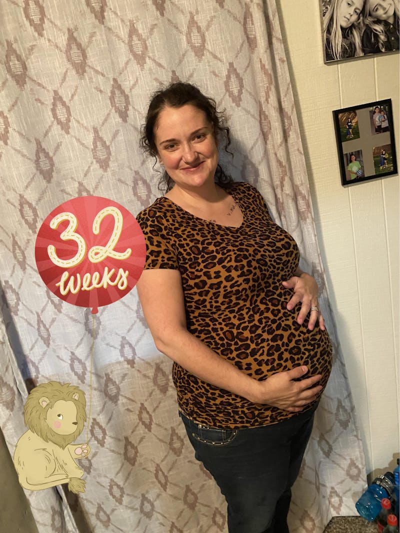 Patients 20-39 Years Old Before & After Gallery - Patient 14494266 - Image 2