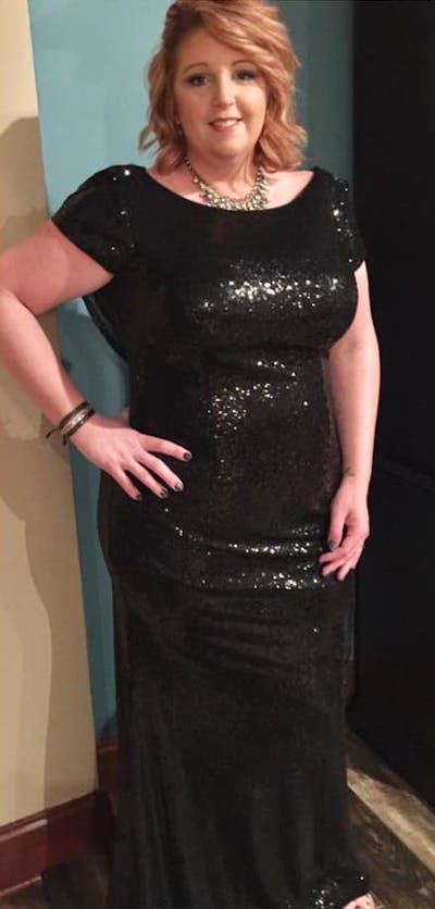 Patients 20-39 Years Old Before & After Gallery - Patient 14494268 - Image 1