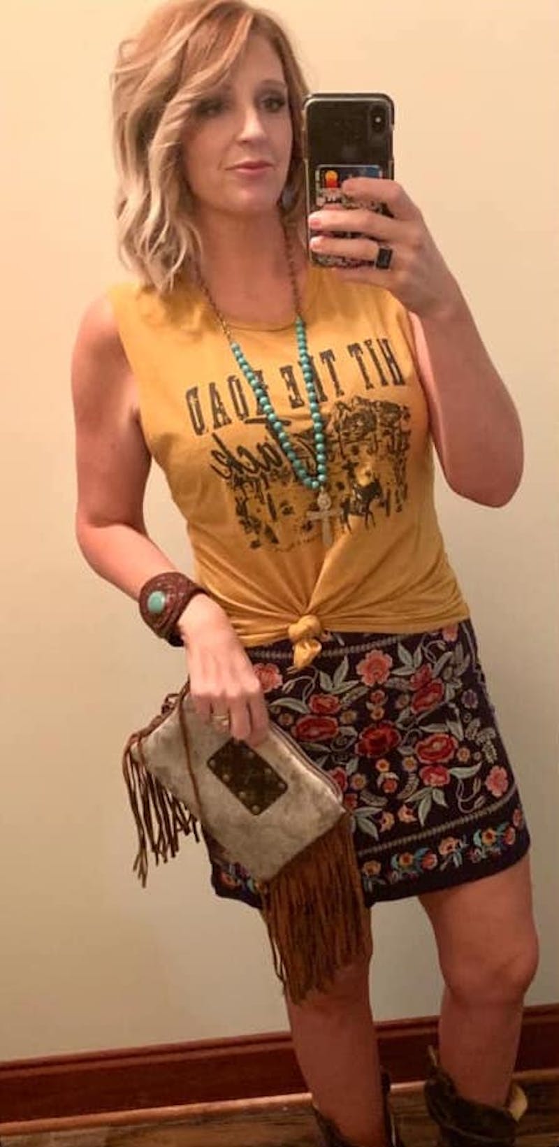 Patients 20-39 Years Old Before & After Gallery - Patient 14494268 - Image 2