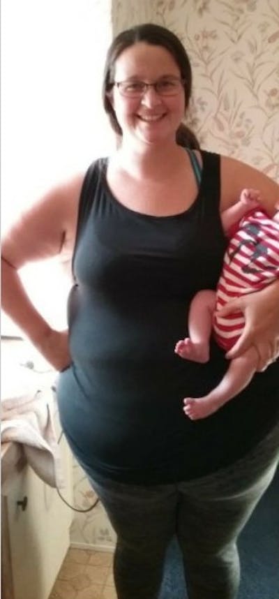 Patients 20-39 Years Old Before & After Gallery - Patient 14494269 - Image 1