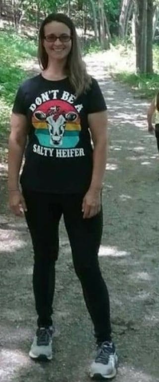 Patients 20-39 Years Old Before & After Gallery - Patient 14494269 - Image 2