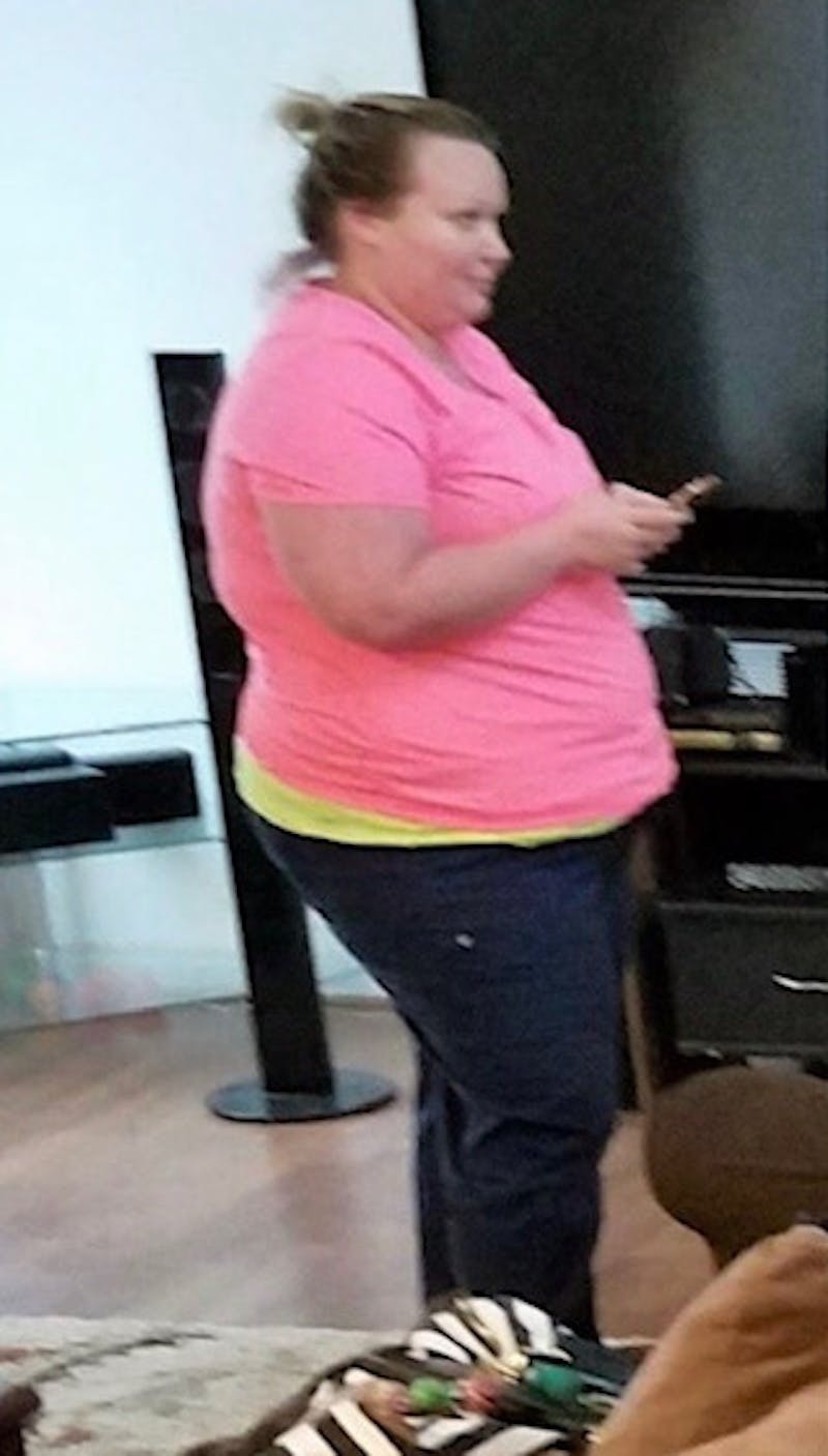 Patients 20-39 Years Old Before & After Gallery - Patient 14494270 - Image 1