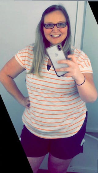 Patients 20-39 Years Old Before & After Gallery - Patient 14494270 - Image 2