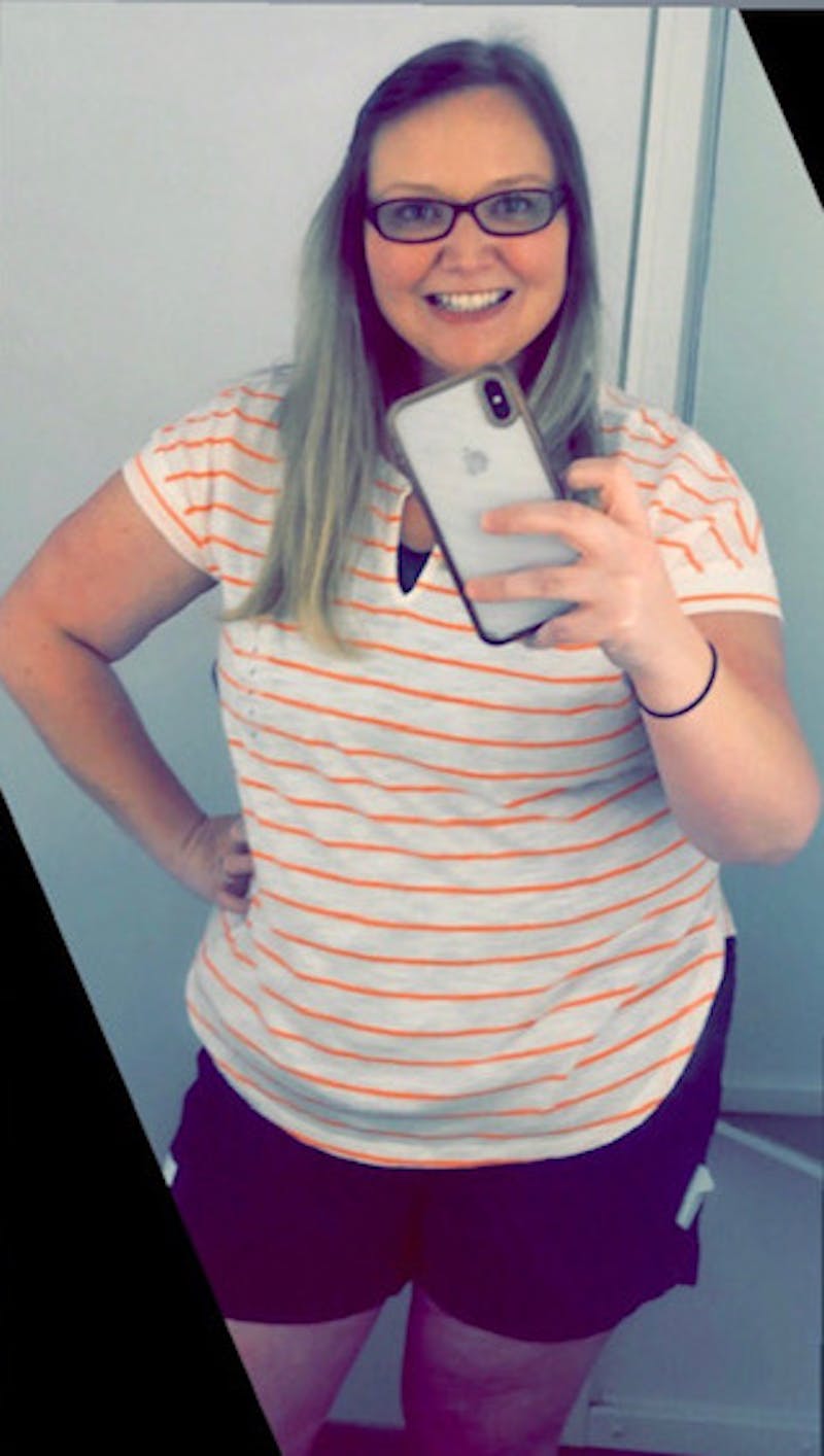 Patients 20-39 Years Old Before & After Gallery - Patient 14494270 - Image 2