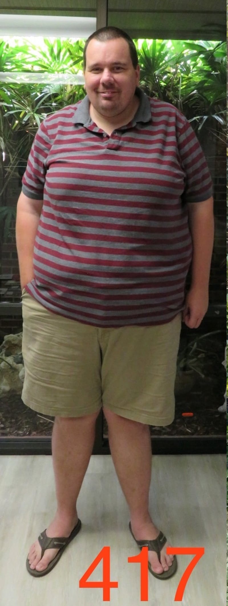 Patients 20-39 Years Old Before & After Gallery - Patient 14494272 - Image 1