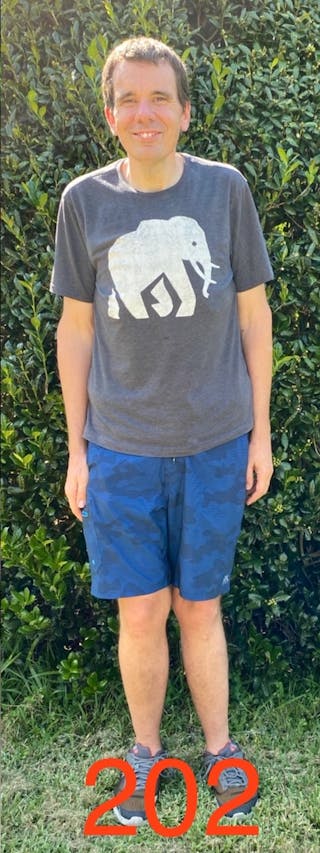 Patients 20-39 Years Old Before & After Gallery - Patient 14494272 - Image 2