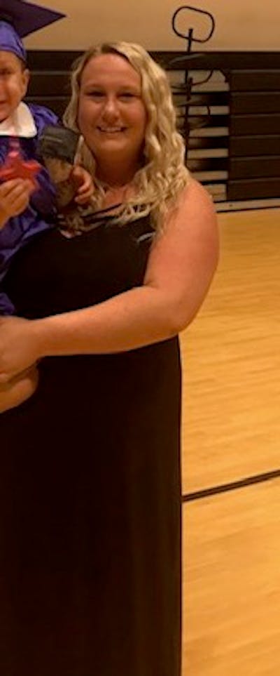 Patients 20-39 Years Old Before & After Gallery - Patient 14494273 - Image 1