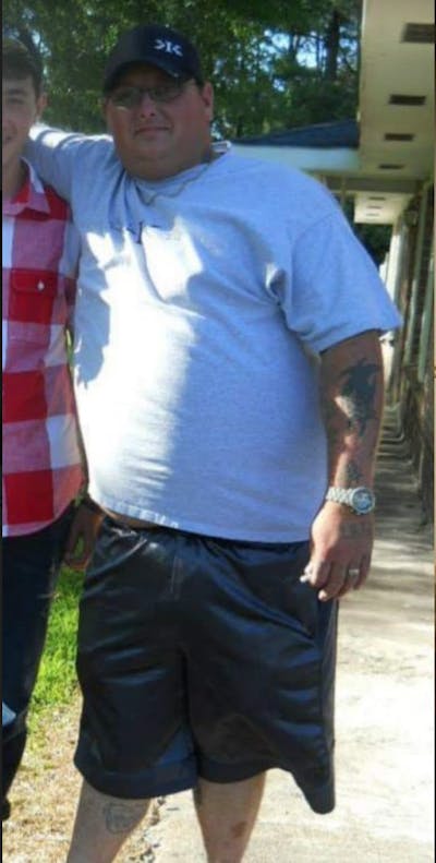 Patients 20-39 Years Old Before & After Gallery - Patient 14494276 - Image 1