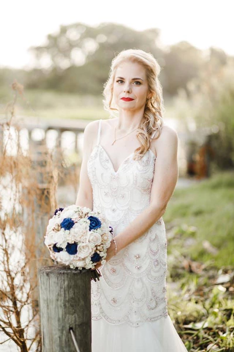 Patients 20-39 Years Old Before & After Gallery - Patient 14494278 - Image 2