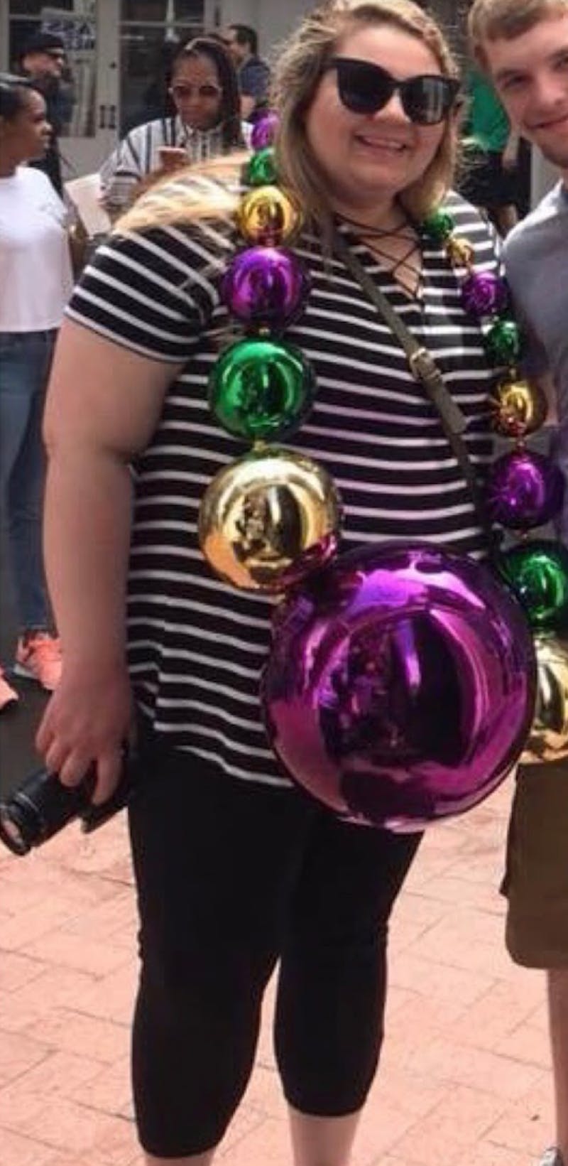 Patients 20-39 Years Old Before & After Gallery - Patient 14494280 - Image 1