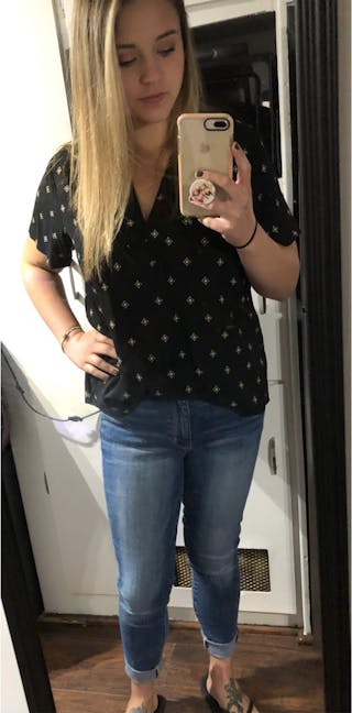 Patients 20-39 Years Old Before & After Gallery - Patient 14494280 - Image 2