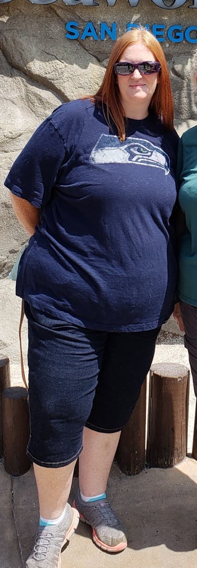 Patients 20-39 Years Old Before & After Gallery - Patient 14494284 - Image 1