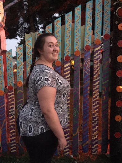 Patients 20-39 Years Old Before & After Gallery - Patient 14494286 - Image 1