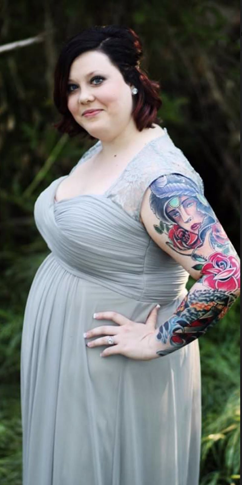 Patients 20-39 Years Old Before & After Gallery - Patient 14494288 - Image 1