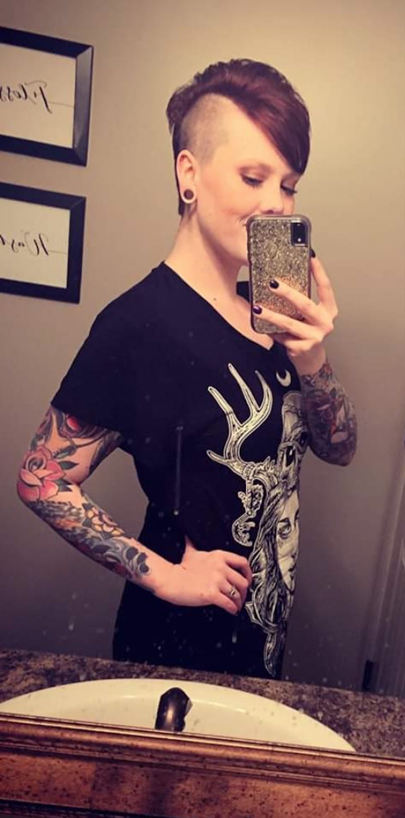 Patients 20-39 Years Old Before & After Gallery - Patient 14494288 - Image 2