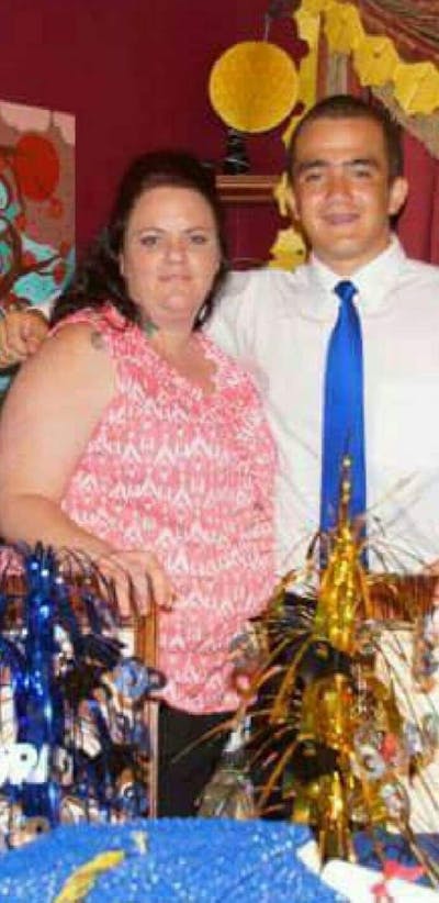 Patients 20-39 Years Old Before & After Gallery - Patient 14494295 - Image 1