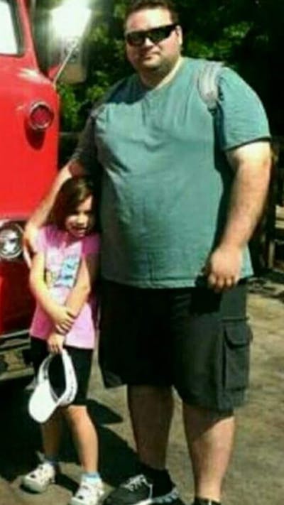 Patients 20-39 Years Old Before & After Gallery - Patient 14494296 - Image 1