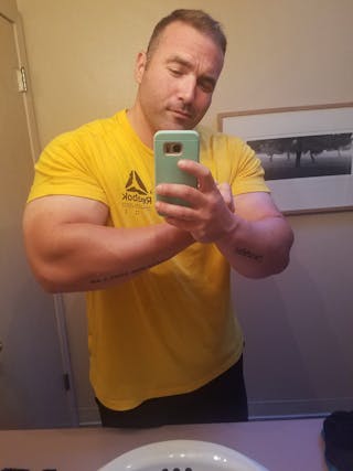 Patients 20-39 Years Old Before & After Gallery - Patient 14494296 - Image 2