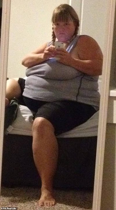 Patients 20-39 Years Old Before & After Gallery - Patient 14494298 - Image 1