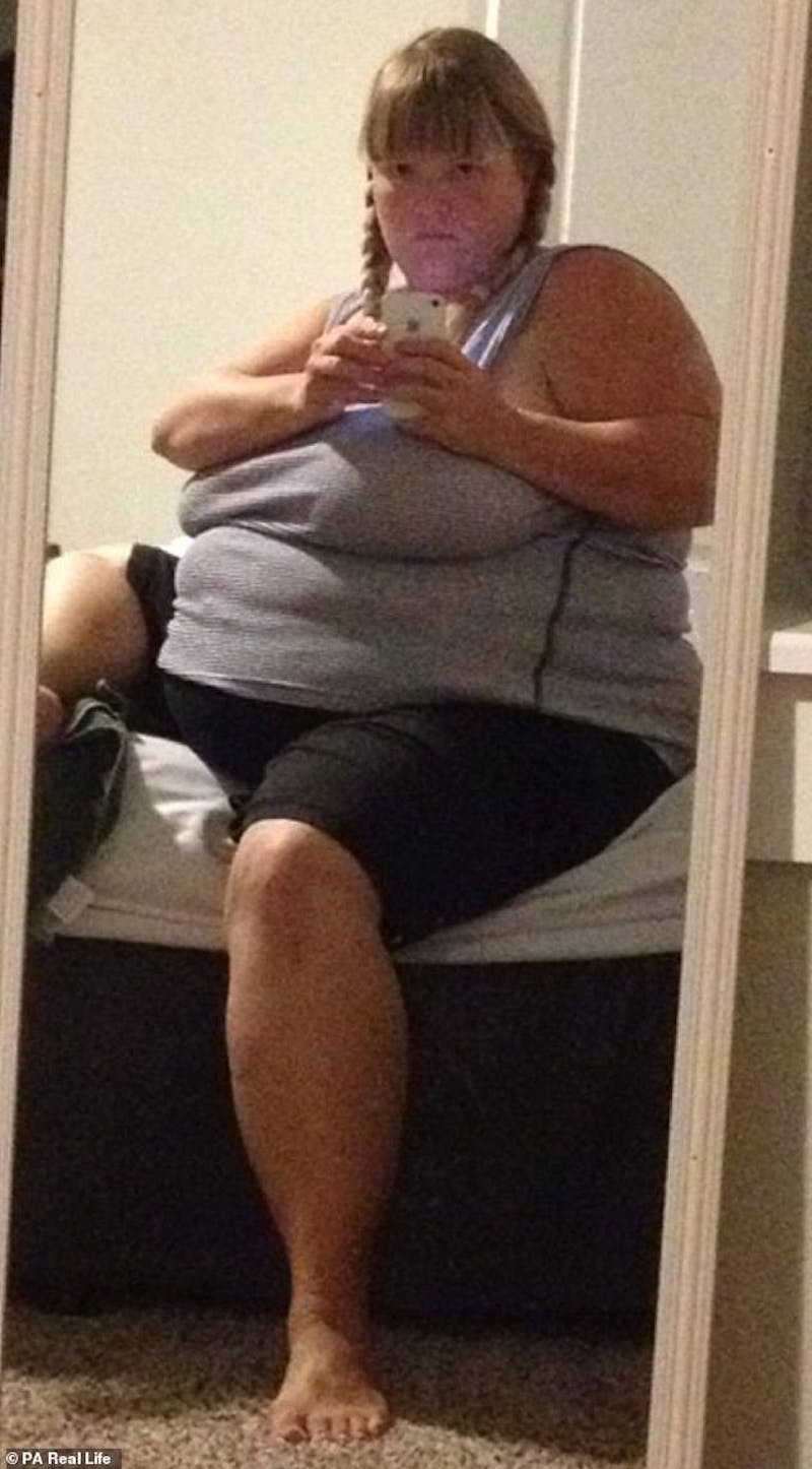 Patients 20-39 Years Old Before & After Gallery - Patient 14494298 - Image 1