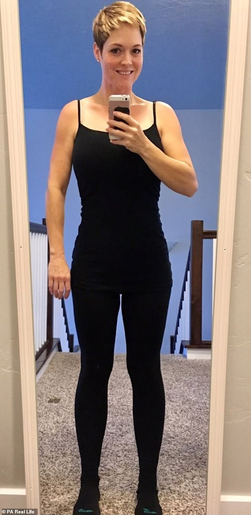 Patients 20-39 Years Old Before & After Gallery - Patient 14494298 - Image 2