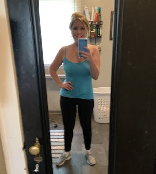 Patients 20-39 Years Old Before & After Gallery - Patient 14494301 - Image 2