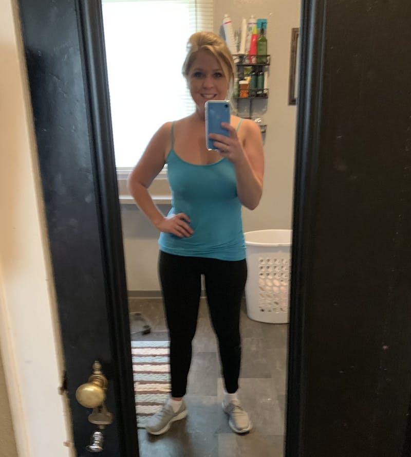 Patients 20-39 Years Old Before & After Gallery - Patient 14494301 - Image 2