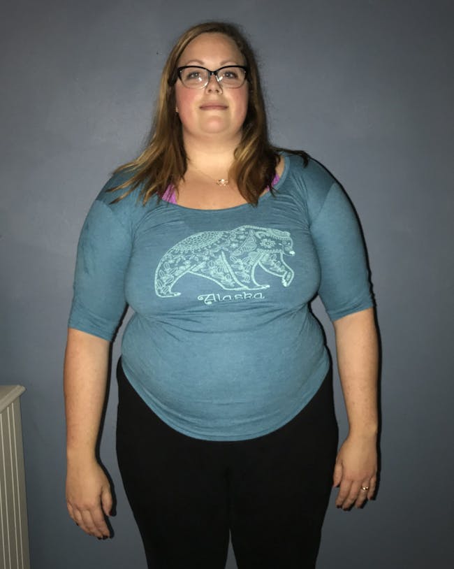 Kylie's patient journey before