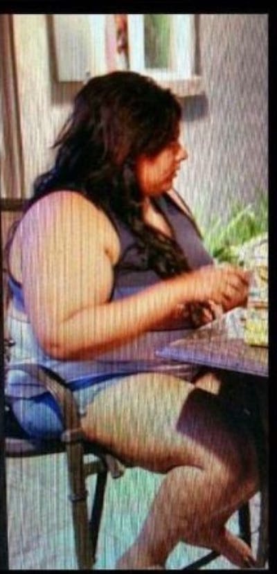 Patients 20-39 Years Old Before & After Gallery - Patient 14494303 - Image 1