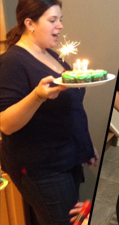 Patients 20-39 Years Old Before & After Gallery - Patient 14494306 - Image 1