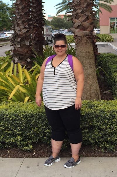 Patients 20-39 Years Old Before & After Gallery - Patient 14494307 - Image 1