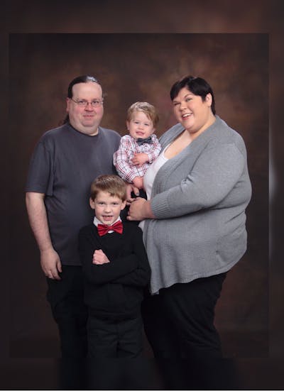 Patients 20-39 Years Old Before & After Gallery - Patient 14494309 - Image 1