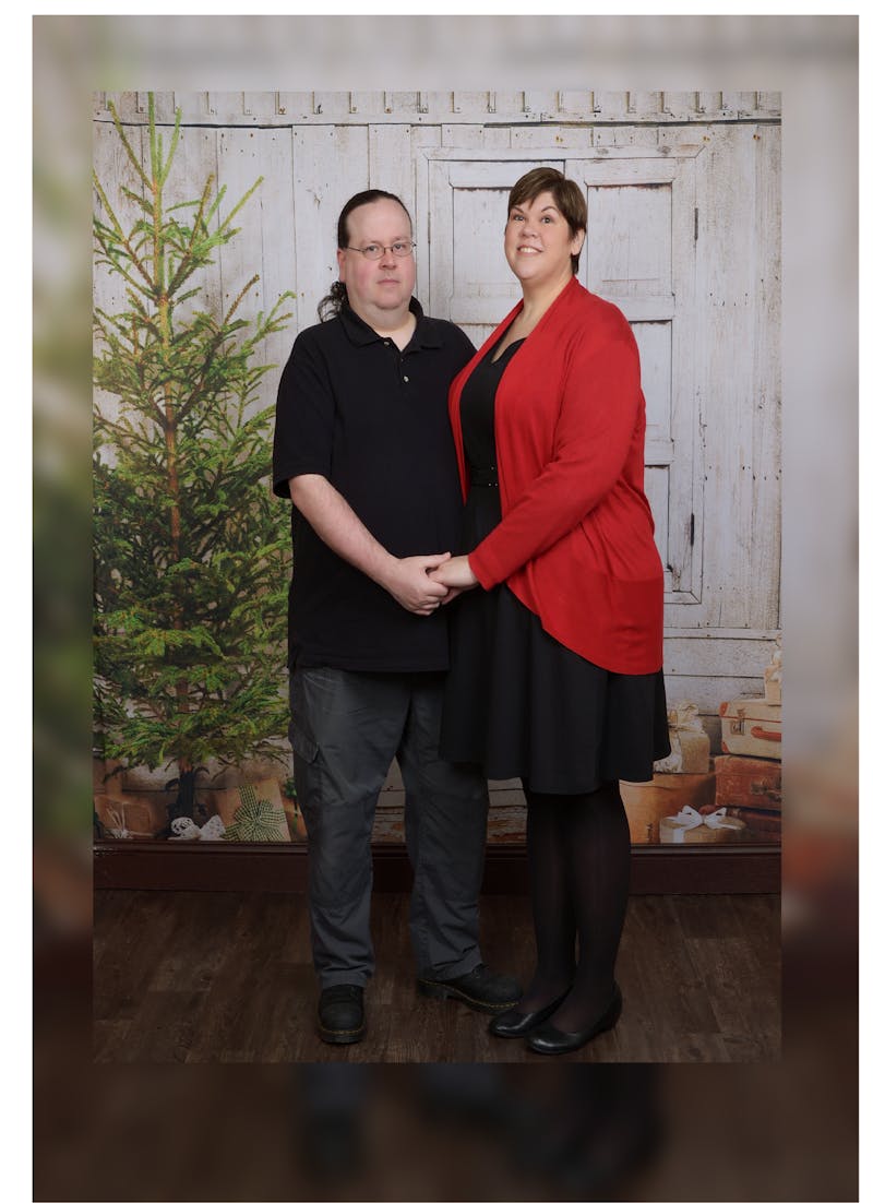 Patients 20-39 Years Old Before & After Gallery - Patient 14494309 - Image 2