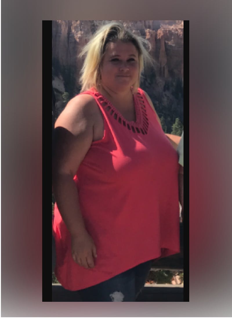 Patients 20-39 Years Old Before & After Gallery - Patient 14494310 - Image 1