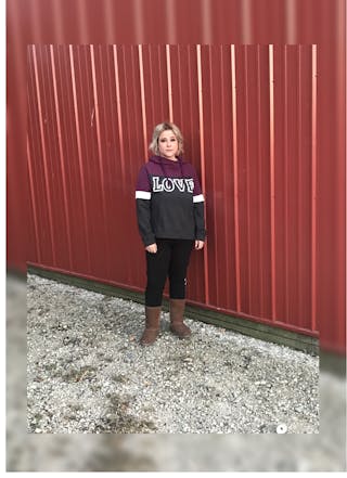 Patients 20-39 Years Old Before & After Gallery - Patient 14494310 - Image 2