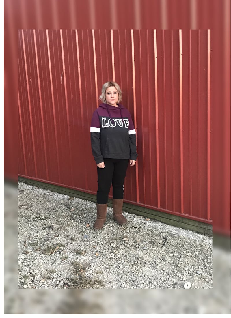 Patients 20-39 Years Old Before & After Gallery - Patient 14494310 - Image 2