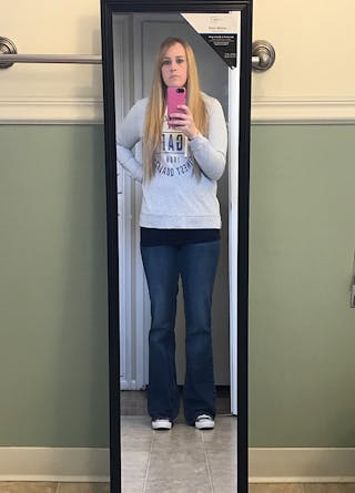 Patients 20-39 Years Old Before & After Gallery - Patient 14494311 - Image 2